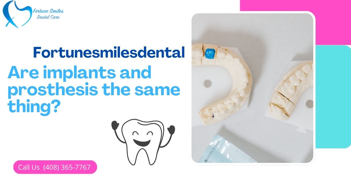 Are implants and prosthesis the same thing?