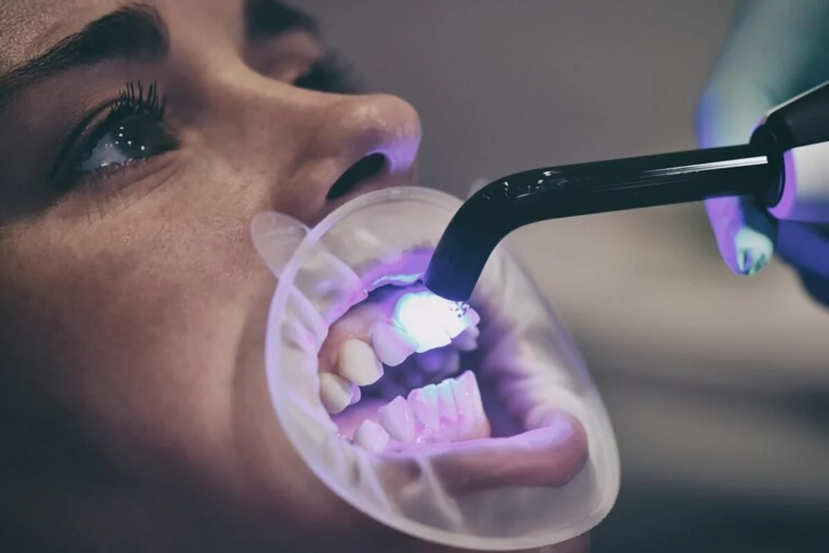 Revolutionizing Restorative Dentistry: Biomimetic Applications in Dental Onlays