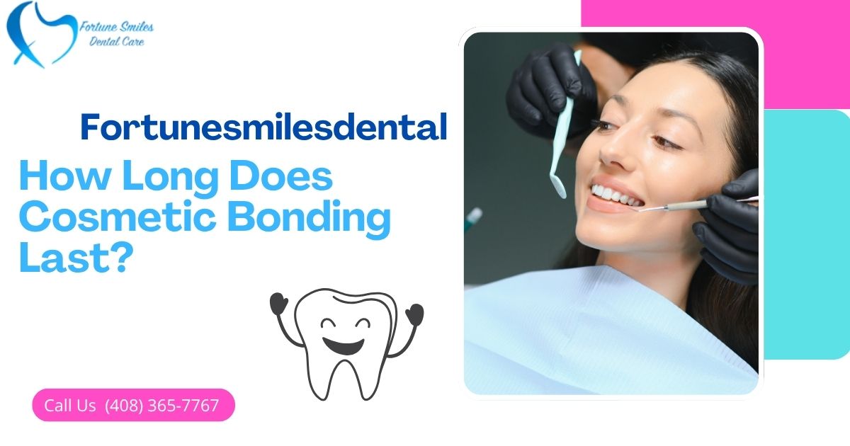 How Long Does Cosmetic Bonding Last?