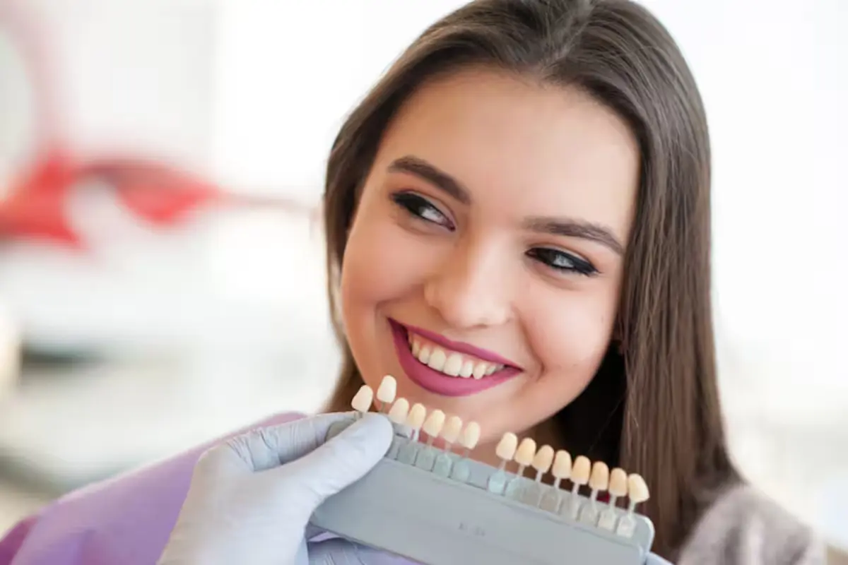 Dental veneers in dentistry