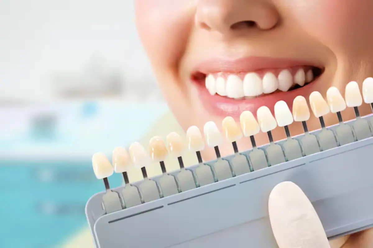 Transforming Smiles with Dental Veneers: Everything You Need to Know