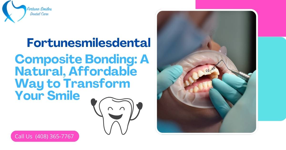 Composite Bonding: A Natural, Affordable Way to Transform Your Smile