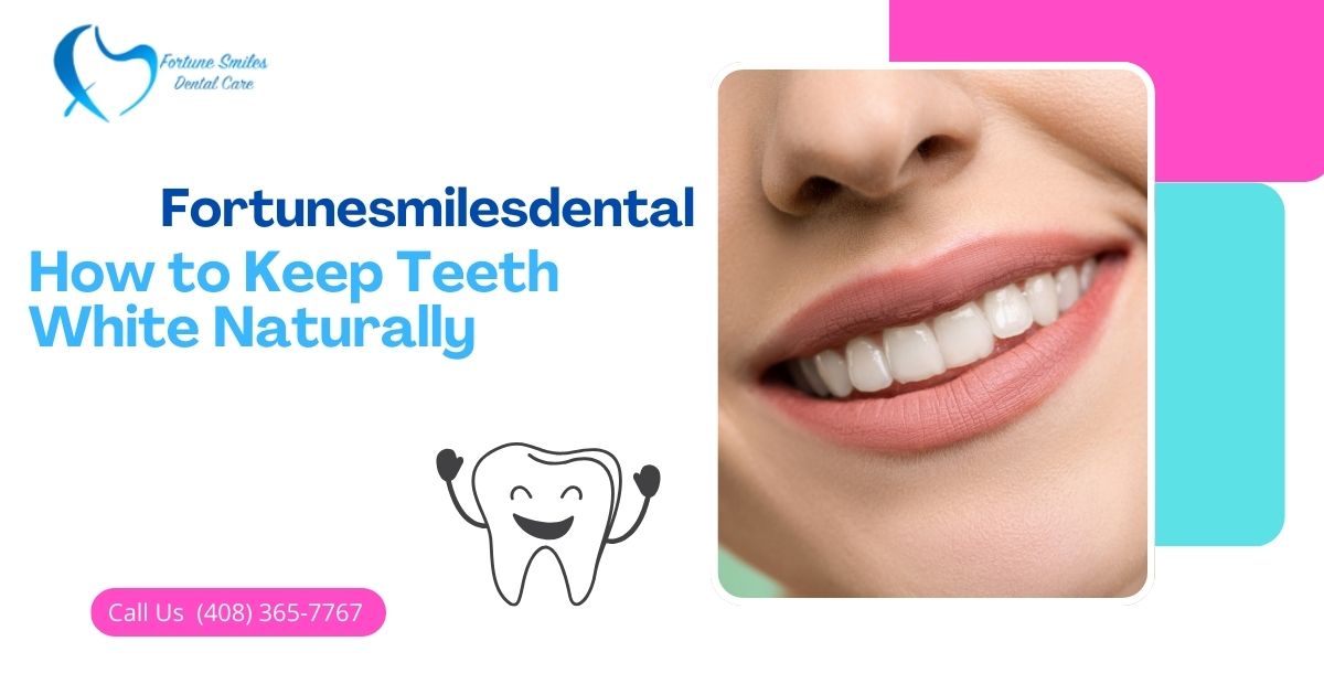 How to Keep Teeth White Naturally