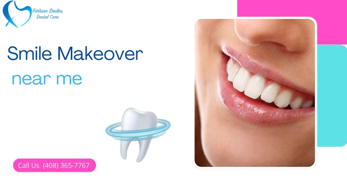 Smile Makeover near me