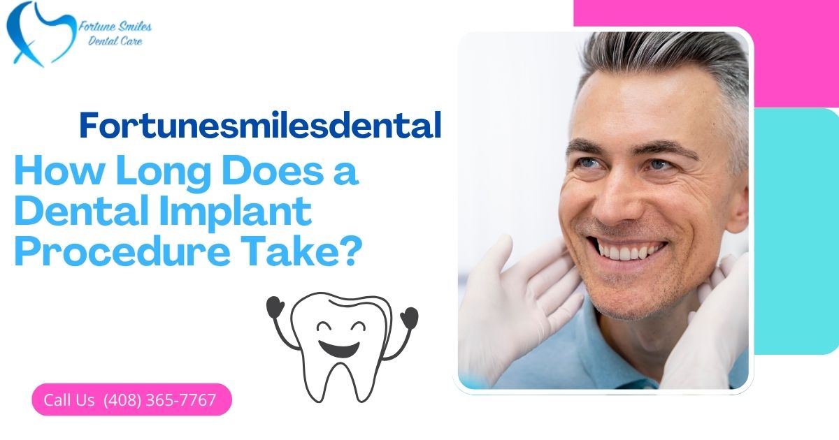How Long Does a Dental Implant Procedure Take?