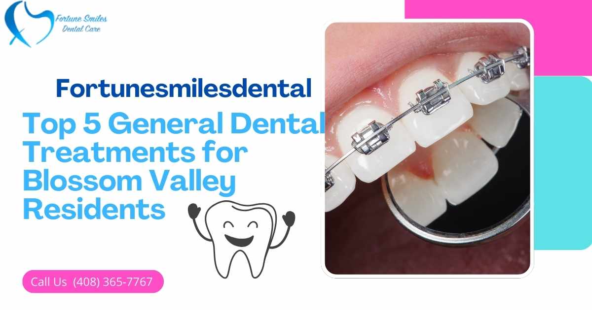 Top 5 General Dental Treatments for Blossom Valley Residents