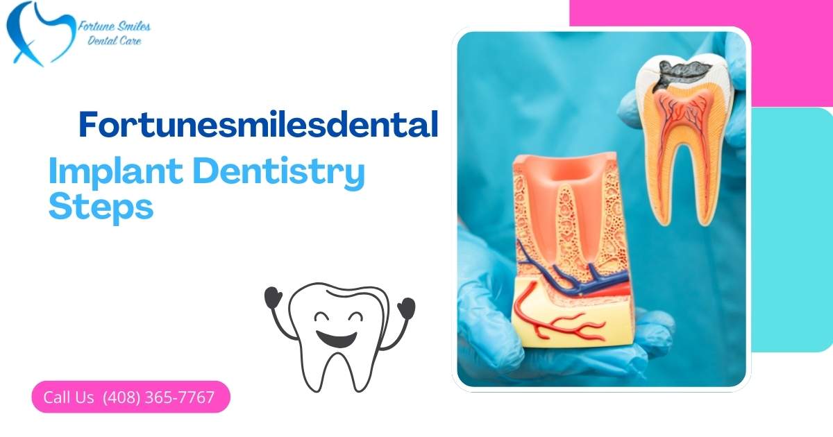Implant Dentistry Steps