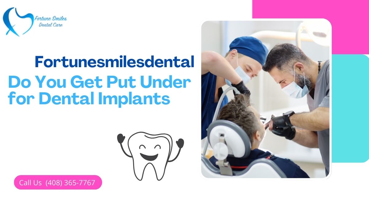 Do You Get Put Under for Dental Implants?