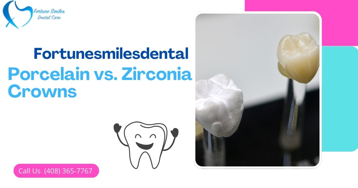 Porcelain vs. Zirconia Crowns: Which Last Longer?