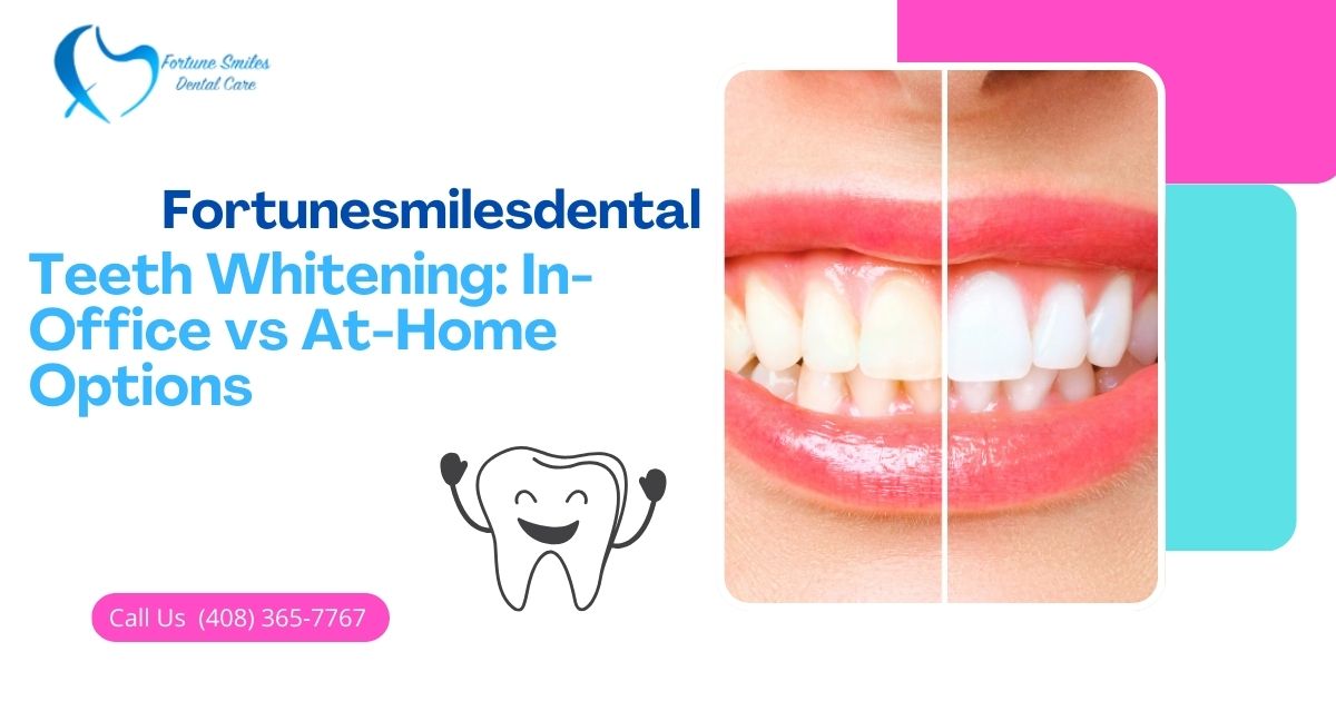 Teeth Whitening: In-Office vs At-Home Options