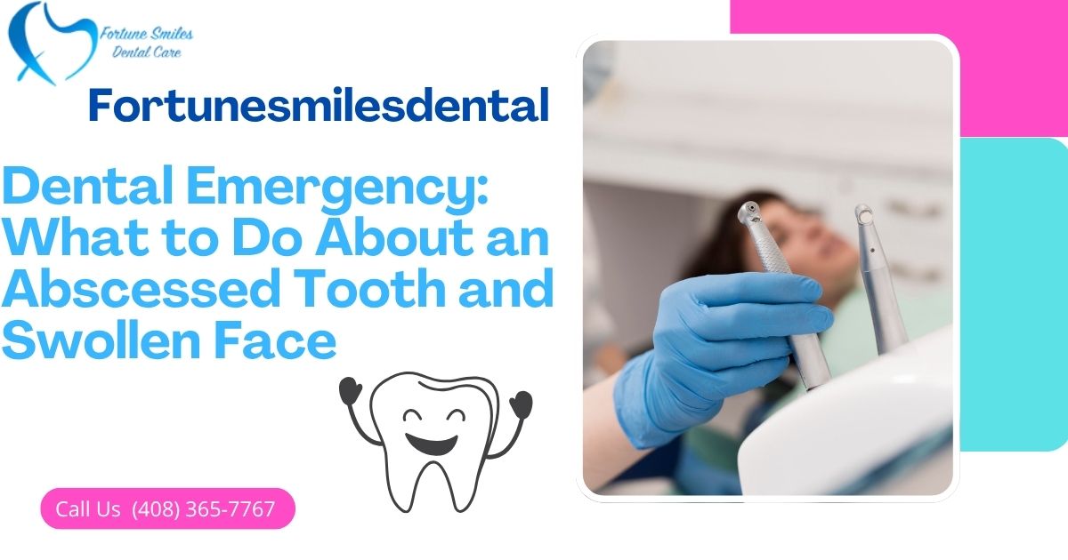 Dental Emergency: What to Do About an Abscessed Tooth and Swollen Face