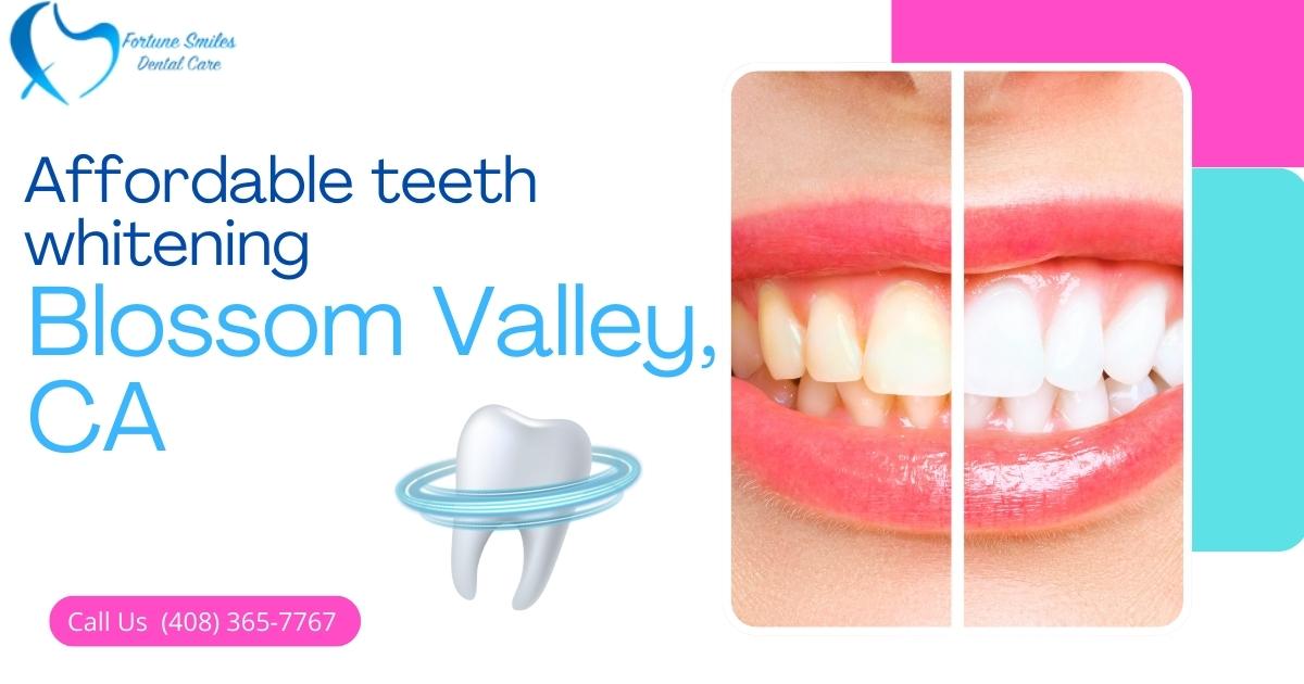 Affordable teeth whitening in Blossom Valley, CA