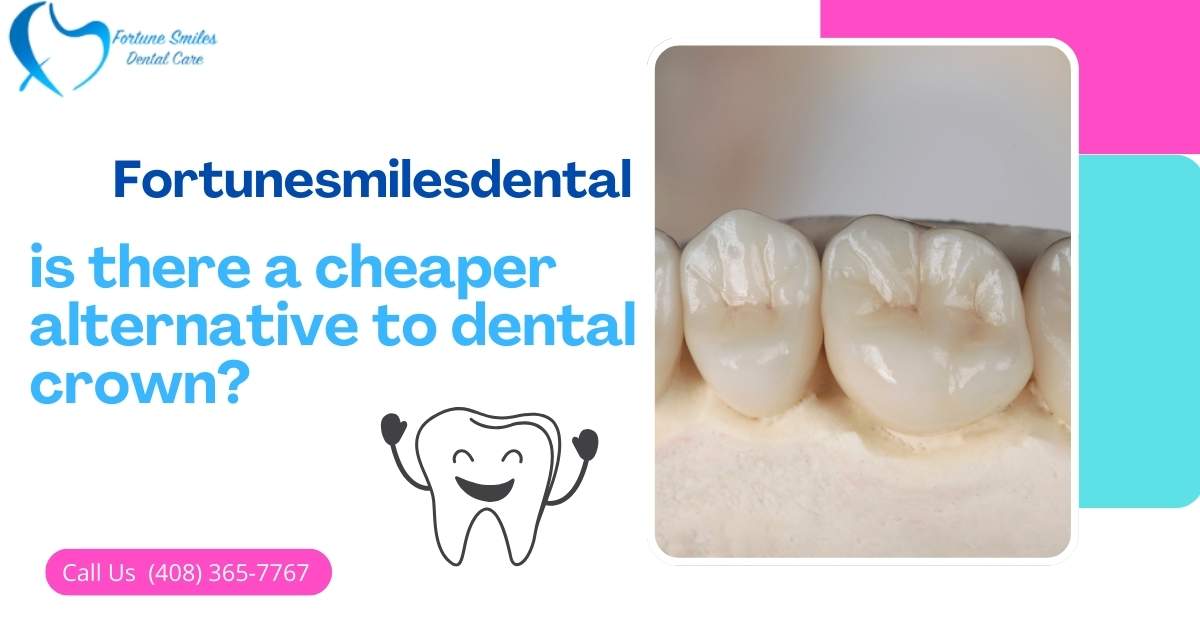 is there a cheaper alternative to dental crown?