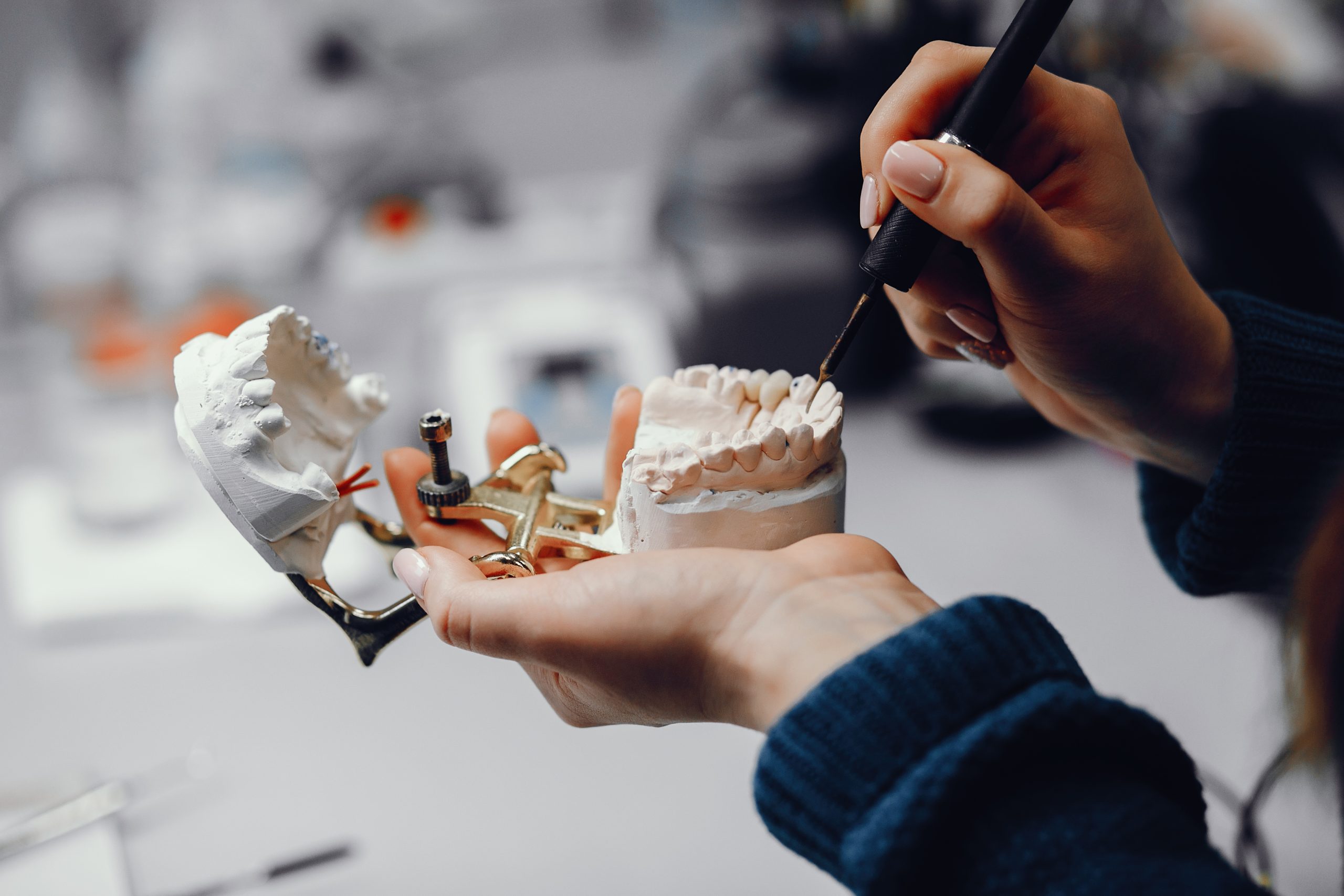 dental implants