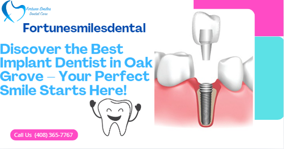 Discover the Best Implant Dentist in Oak Grove – Your Perfect Smile Starts Here!