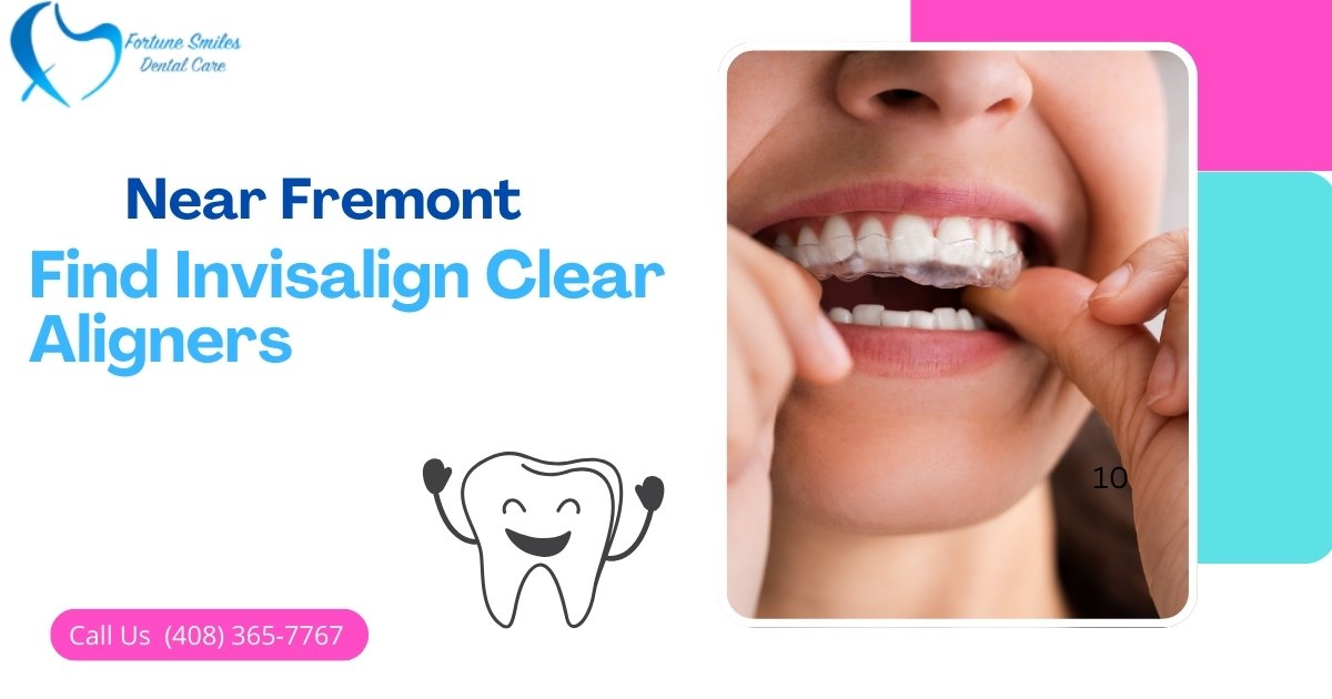 how to find Invisalign Clear Aligners Near Fremont