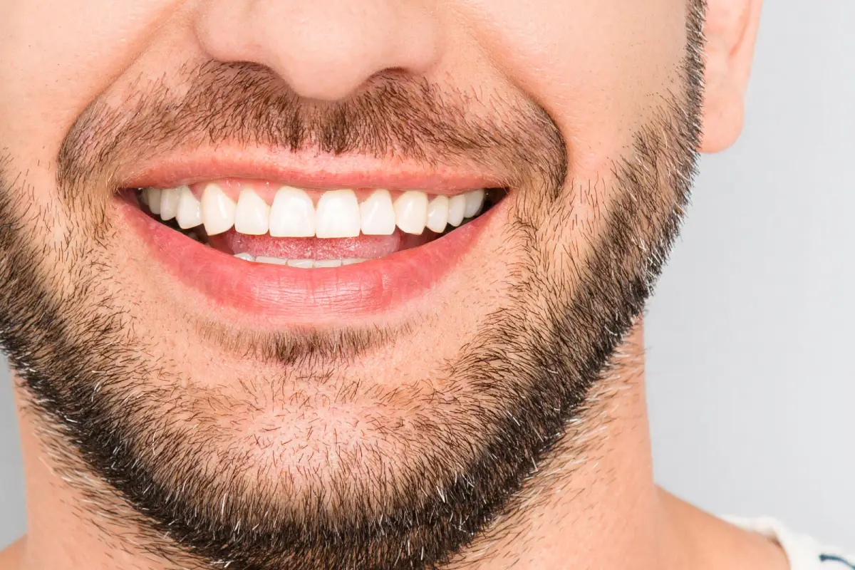 A Comprehensive Guide to Dental Veneer Materials
