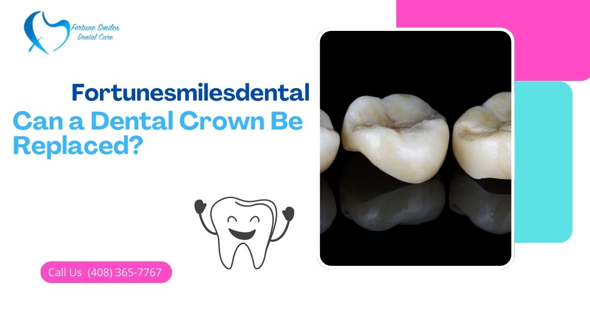 Can a Dental Crown Be Replaced? What Patients Need to Know
