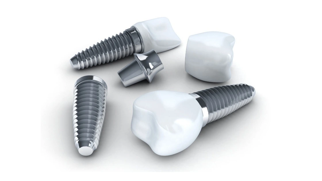 Procedure for Dental Implants