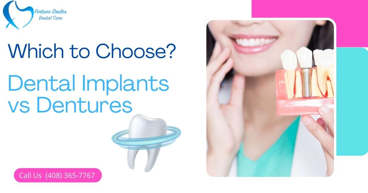 Why Choose Dental Implants Over Dentures?