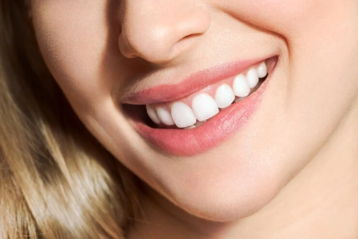 Shine Bright: Embracing Professional Teeth Whitening for Lasting Smiles