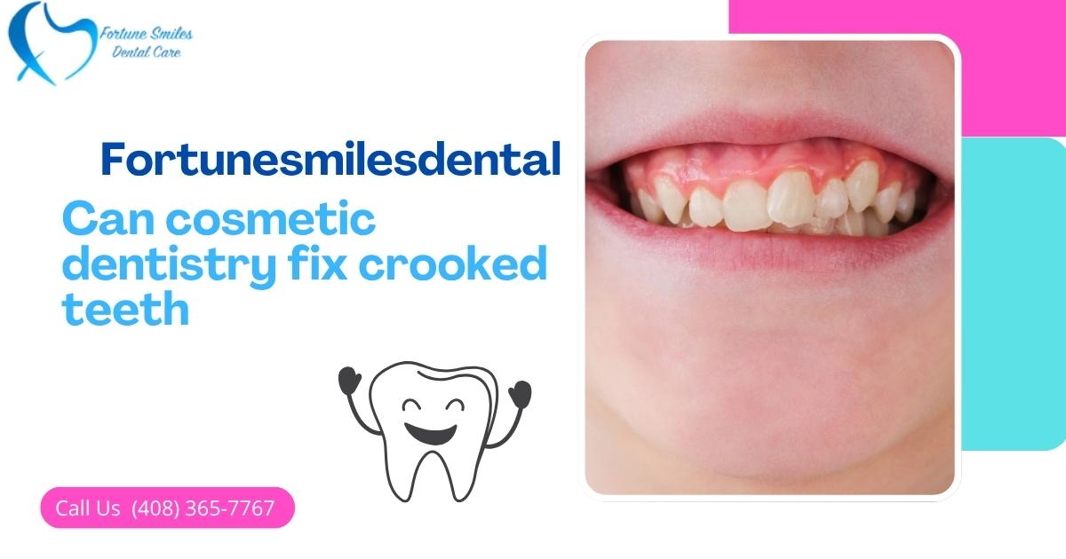 Can cosmetic dentistry fix crooked teeth