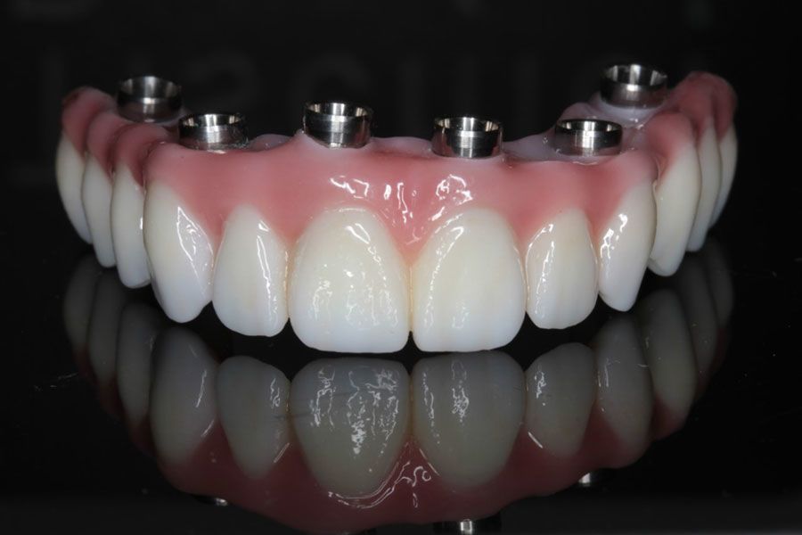 fullmouth3