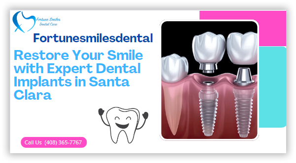 Restore Your Smile with Expert Dental Implants in Santa Clara